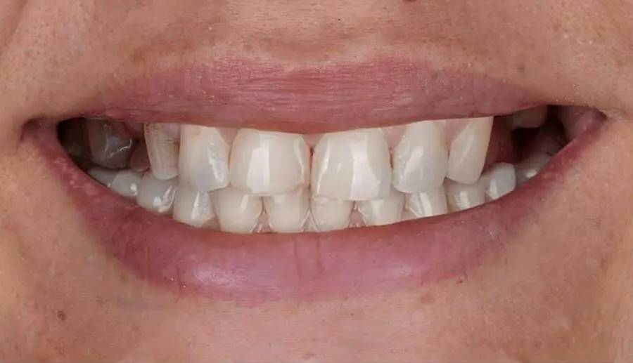 Smile before treatment