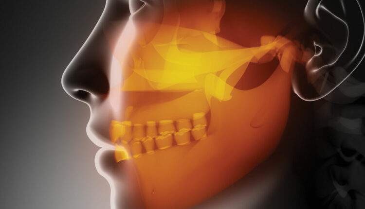 Jaw and joint disorders